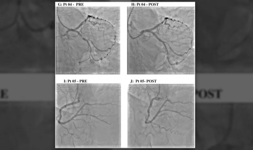 צילום המדגים את ההליך הרפואי שבוצע מרחוק