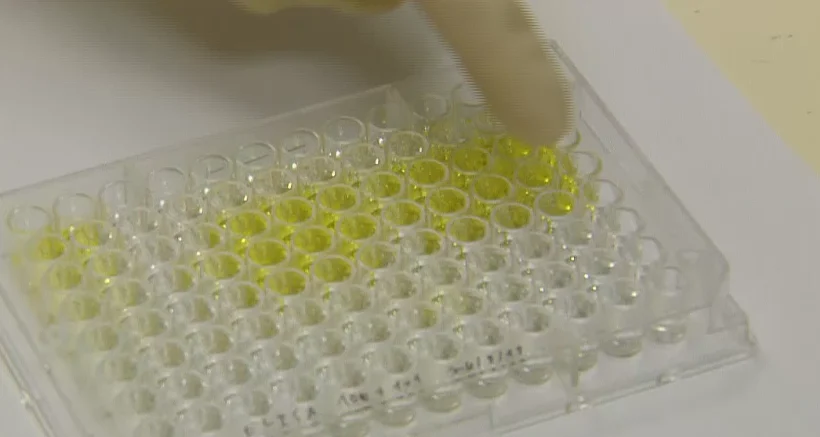 ניסוי בתאים סרטניים