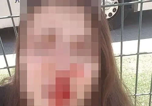 האישה שנחשד כי הותקפה בעפולה ע