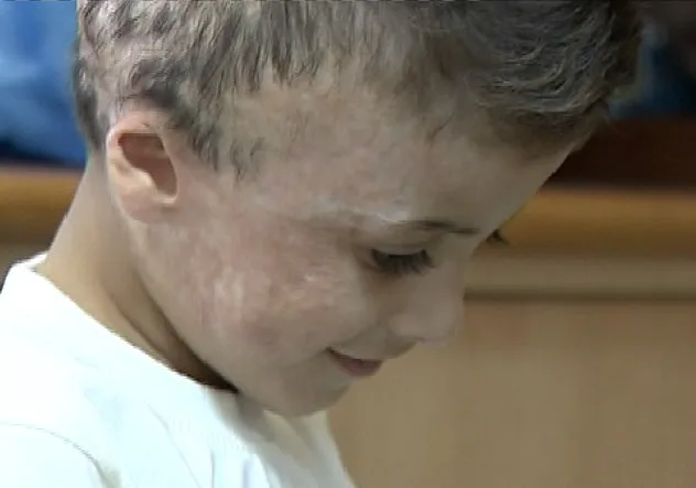 האחות איילת חרמון ואחמד דוואבשה בבית החולים שיב