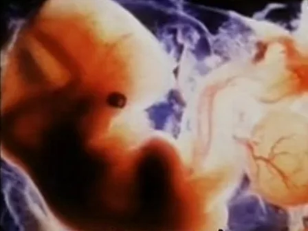 היריון, אילוסטרציה