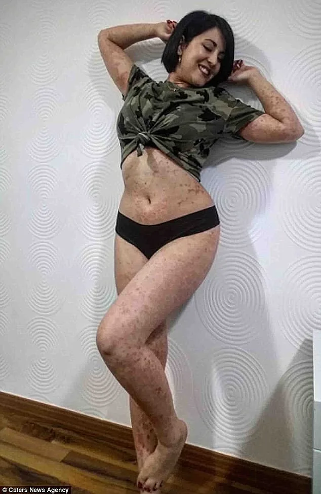 כבר לא מסתתרת מאחורי המחלה