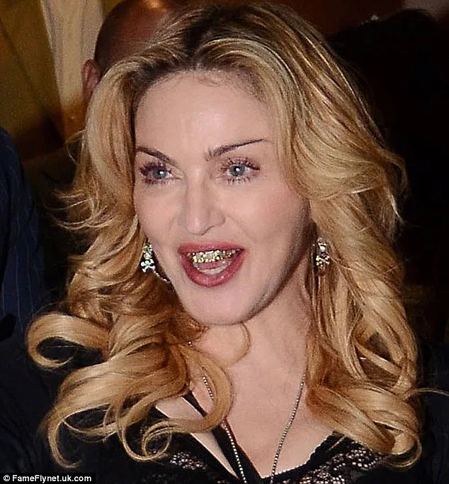 תכשיט שיניים