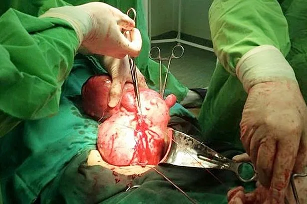 אישה בהיריון נחרדה לגלות: זה היה גידול