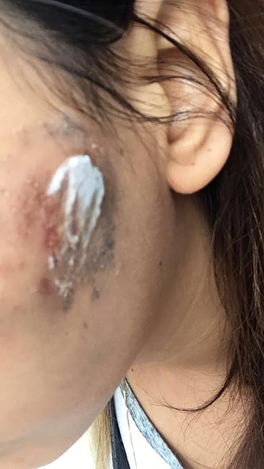 הכוויה של ים