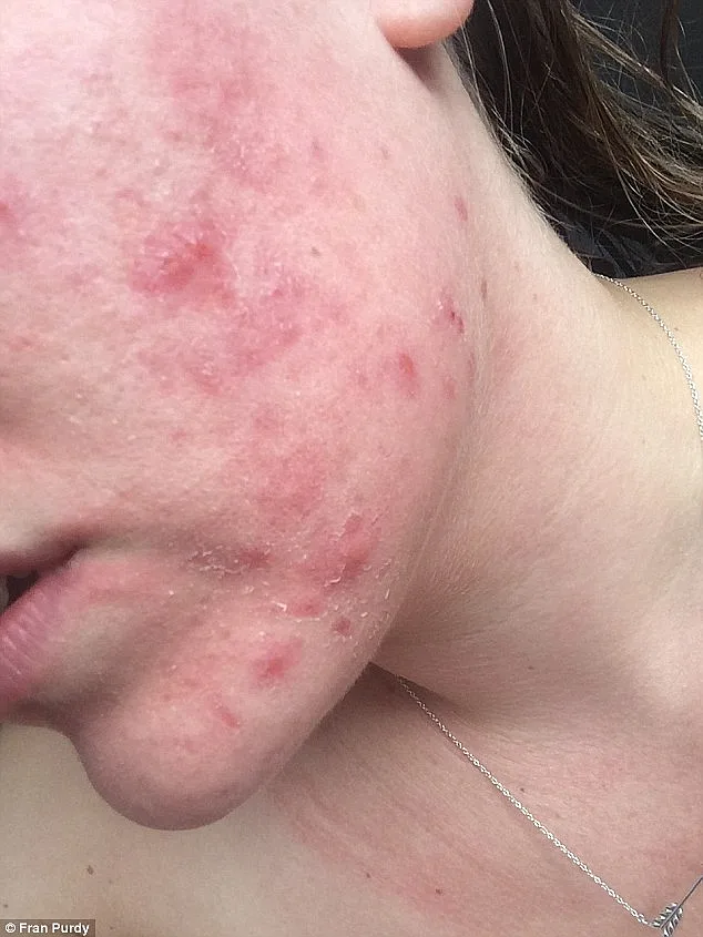 עברה שיימינג ברשת בגלל איפור