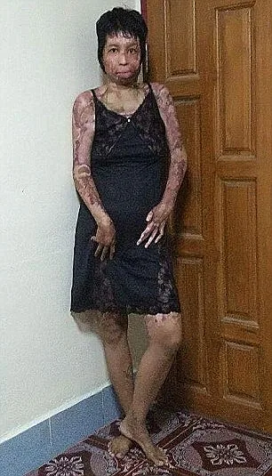 הבעיר את אשתו