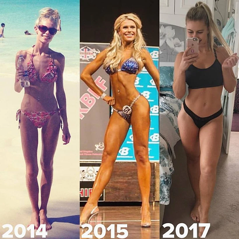 השתקמה מאנורקסיה בזכות המשקולות