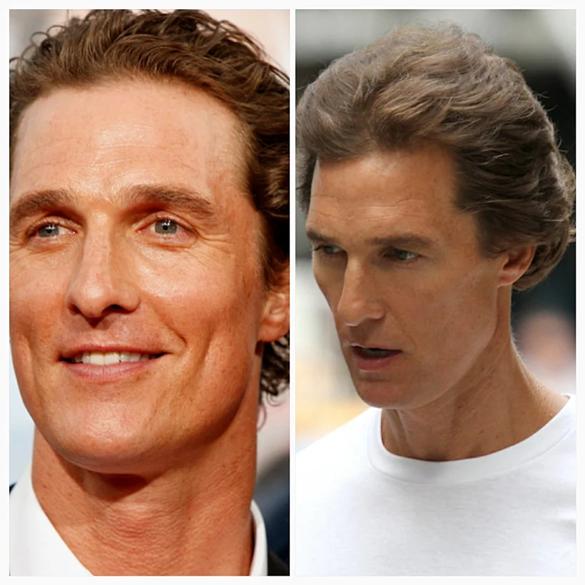 לפני ואחרי: הסלבס התכווצו!