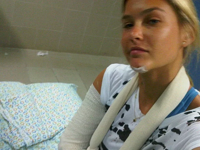 בר רפאלי בגבס