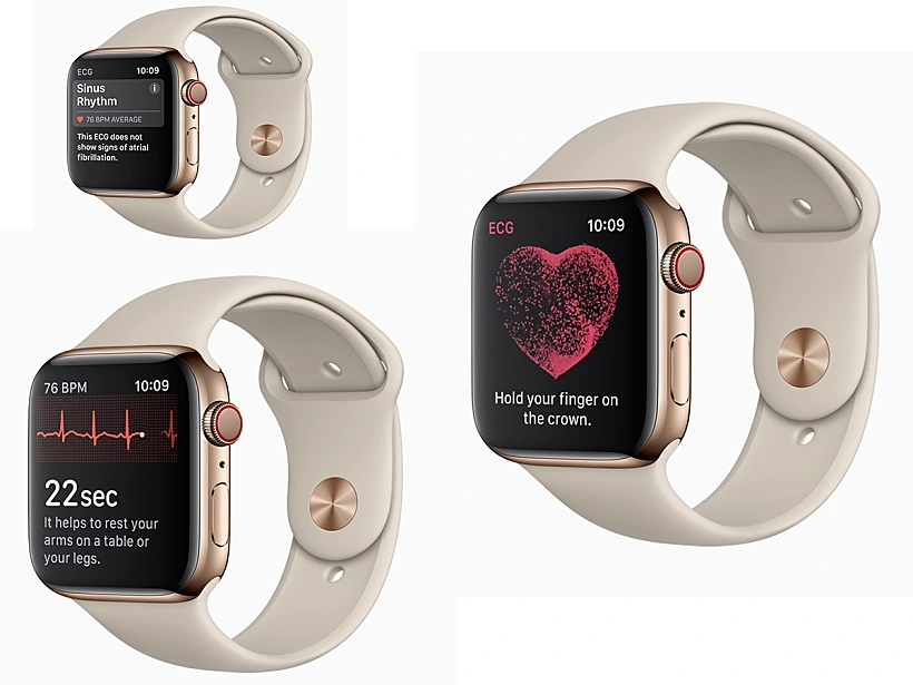 השעון של אפל הופך לאביזר רפואי