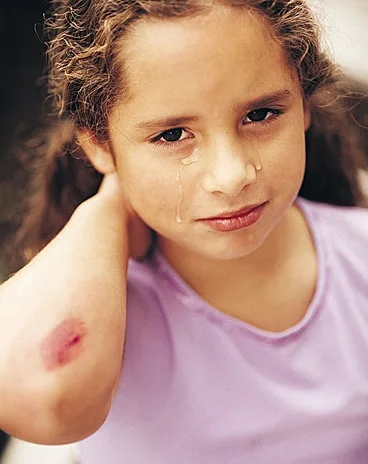 ילדה שפצעה ביד