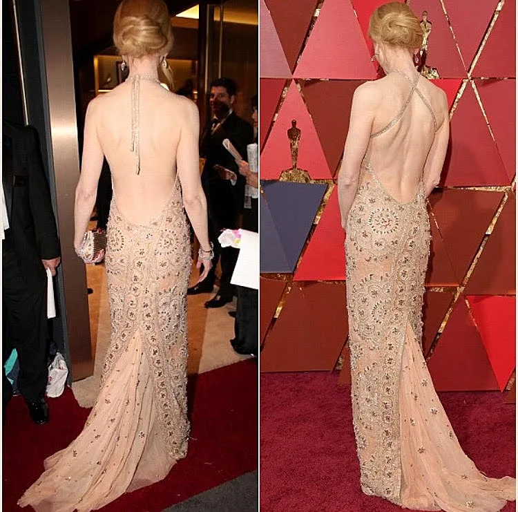 ניקול קידמן לפני ואחרי