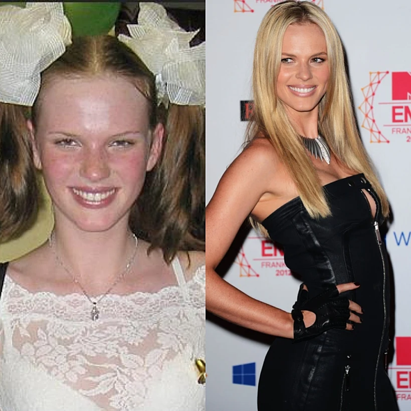 מילדות לדוגמניות