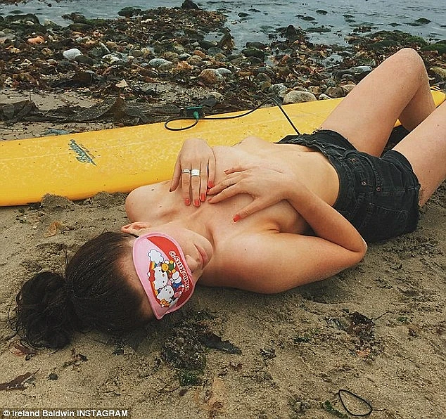 אירלנד בולדויין