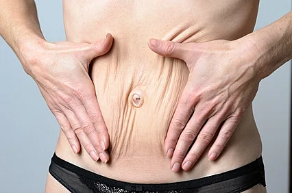 מה כוללת הערכות לניתוח?