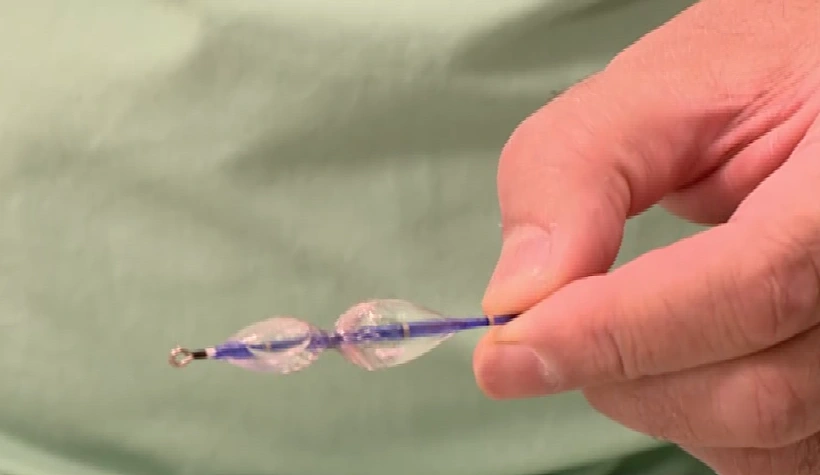 הרדיוסר שתפקידו להצר את וריד-הלב