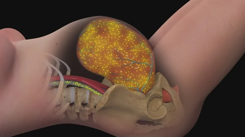 הדמיית בדיקות האם והעובר