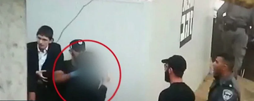 אלימות משטרתית והפיצוי: חרדי שהותקף ע''י שוטר יקבל 17 אלף שקל