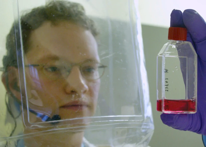A Virologist Displays A Sample Containing The Sars Virus In Hamburg.