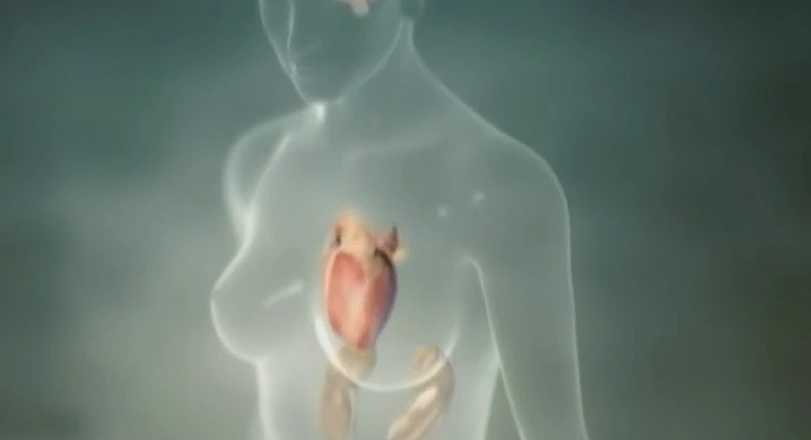 תסמונת הלב השבור