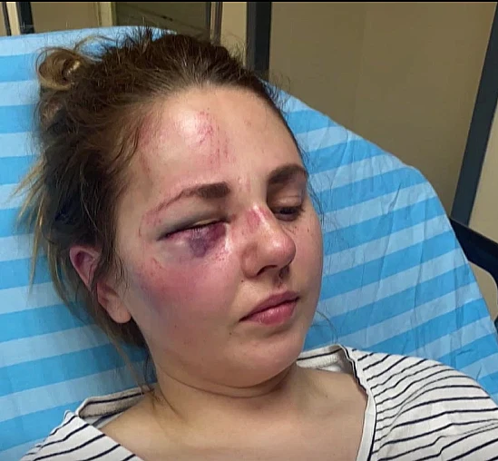 נטליה פרוסקורוב, האחות שהותקפה