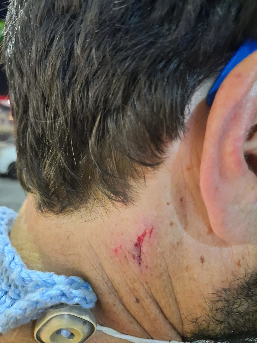 מפגין נדקר בצוואר במהלך הפגנה בשער הנגב