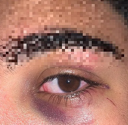 נער מגן יבנה שהותקף