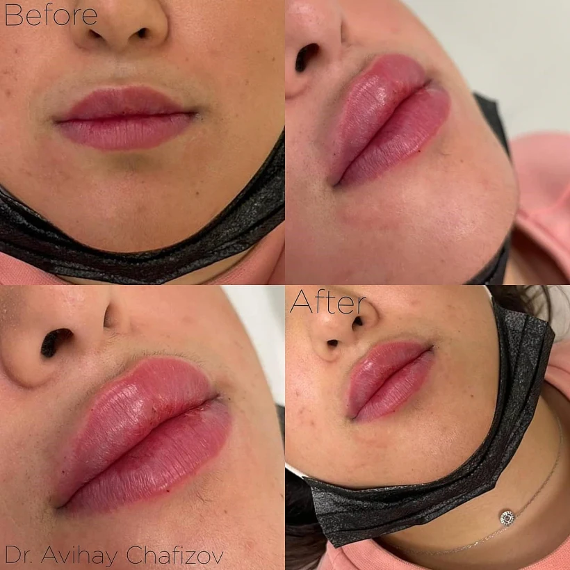 משפתיים דקות לשפתיים עם נוכחות בזמן קצר - HD ביוטי