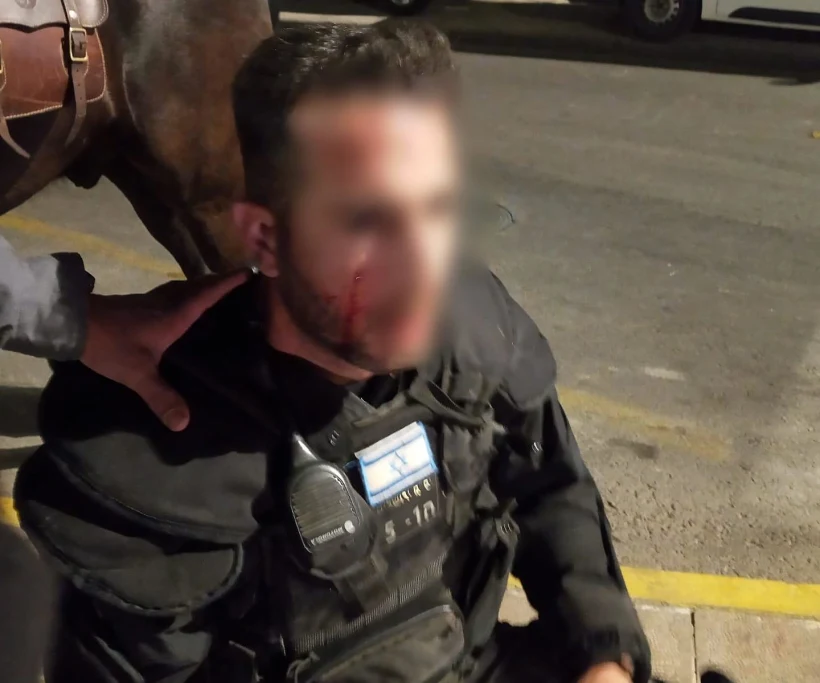 שוטר מיחידת הפרשים נפצע מאבן בפניו