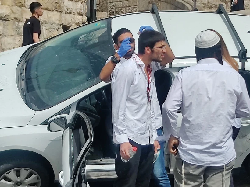 נהג רכב שהותקף בירושלים