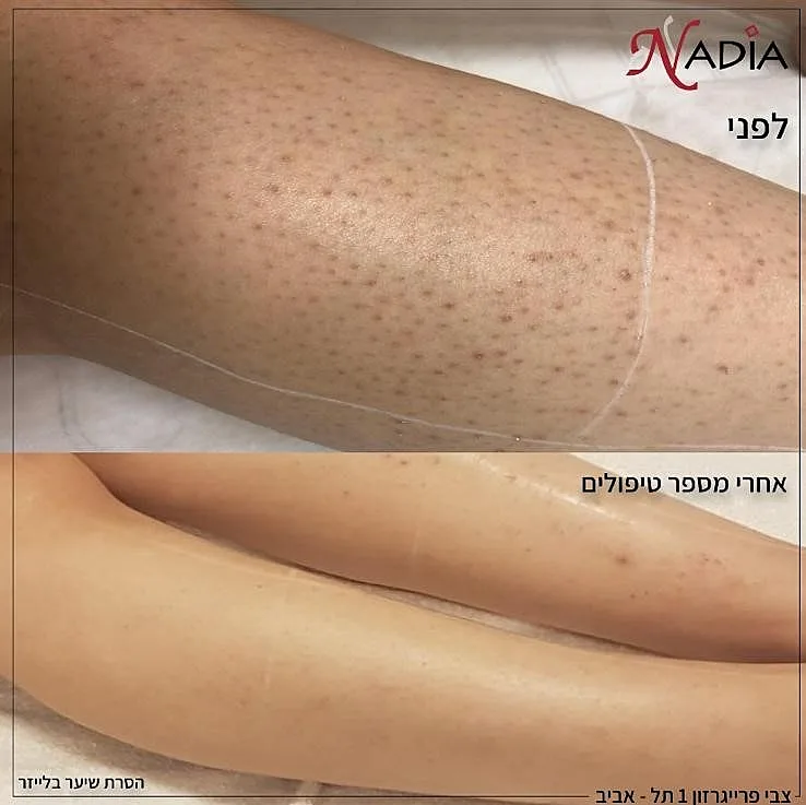 נדיה אסתטיקס