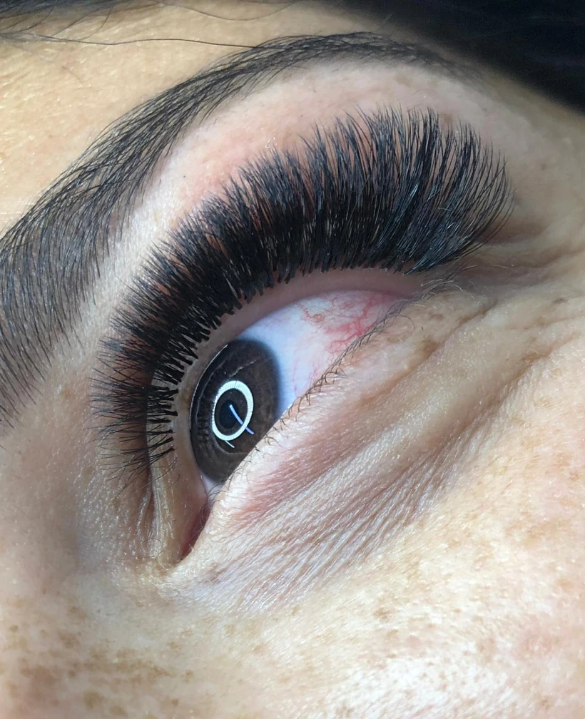 טיפולי פנים אצל רויטל בניסטי