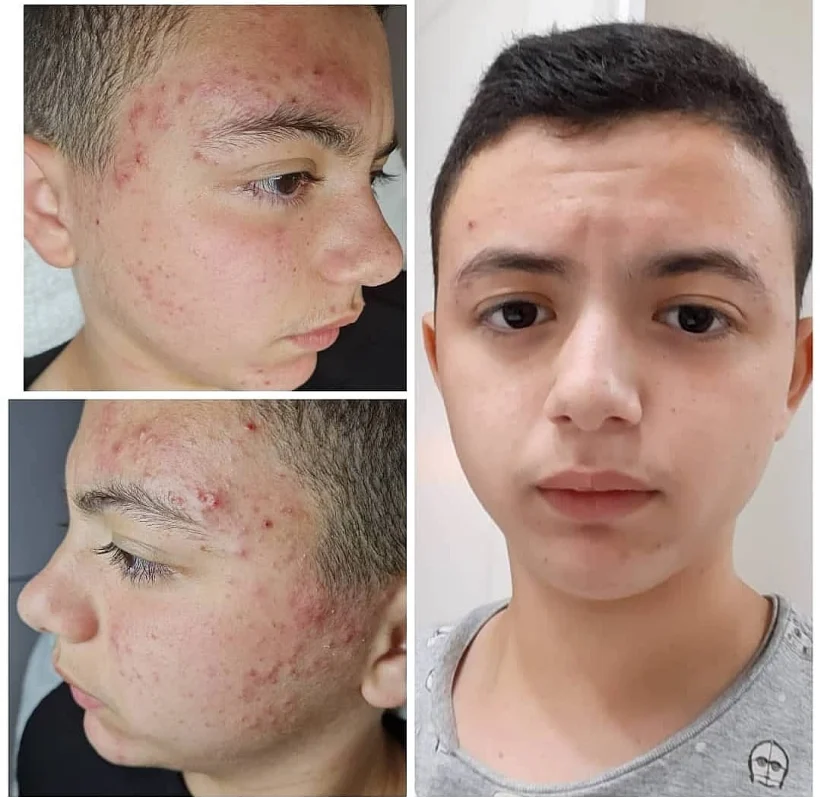 טיפולי פנים אצל שרי לוי שרי קוסמטיקס