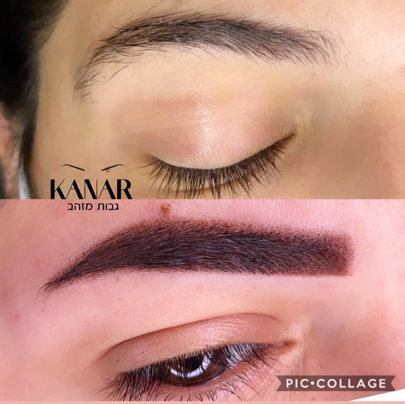 טיפול בגבות אצל קנאר