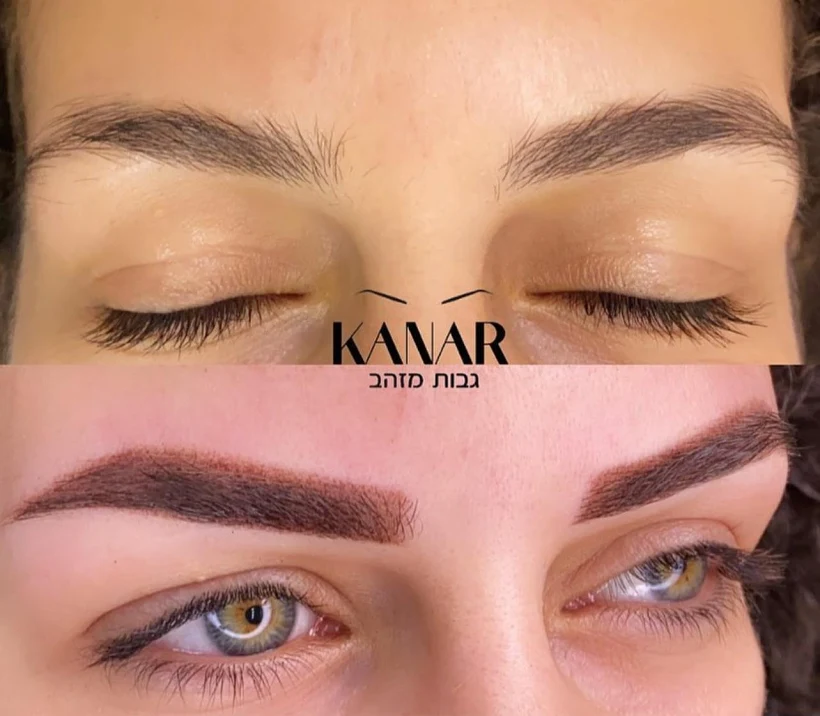 טיפול גבות אצל קאנר