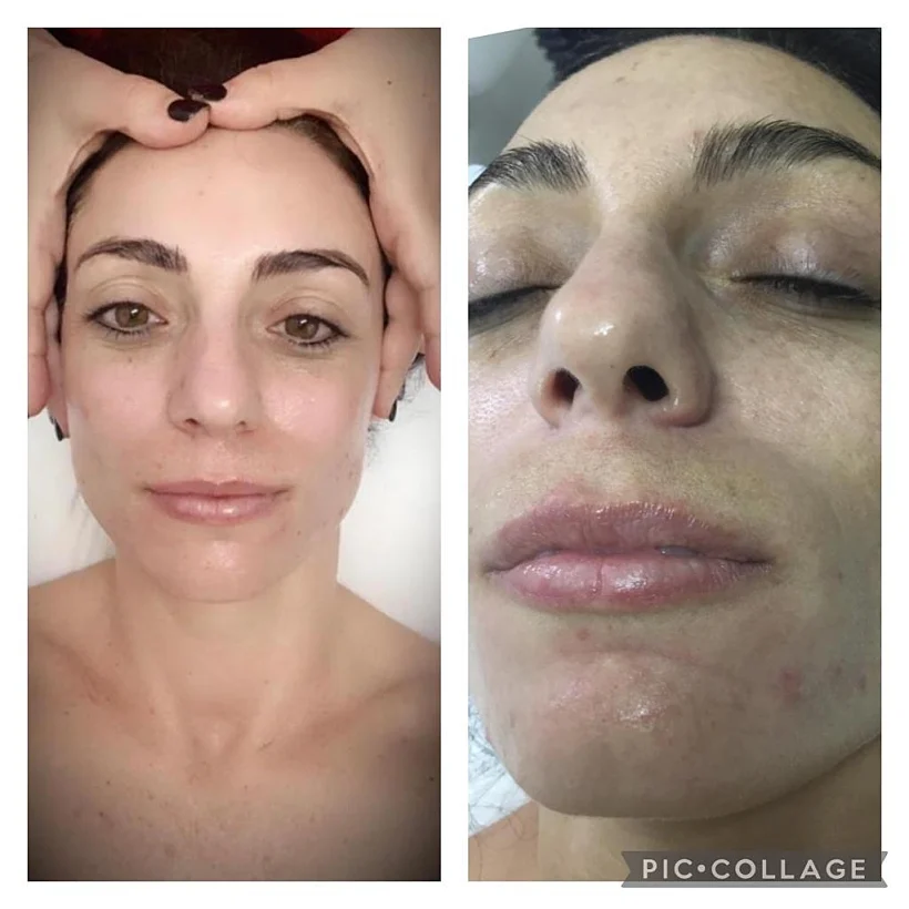 טיפול פנים אצל שרי ארז