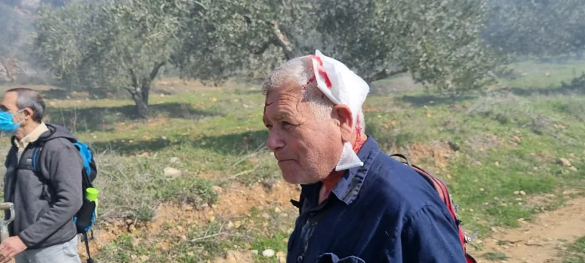 אחד הפעילים שהותקף על ידי המתנחלים
