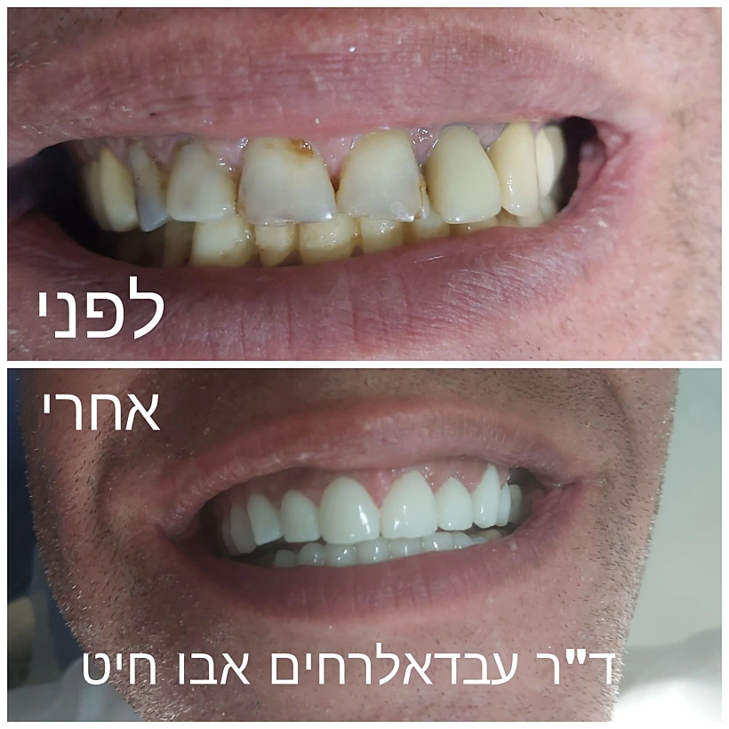 שיניים