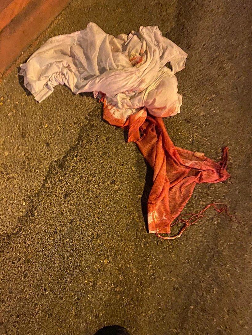 דם זירת פיגוע אלעד