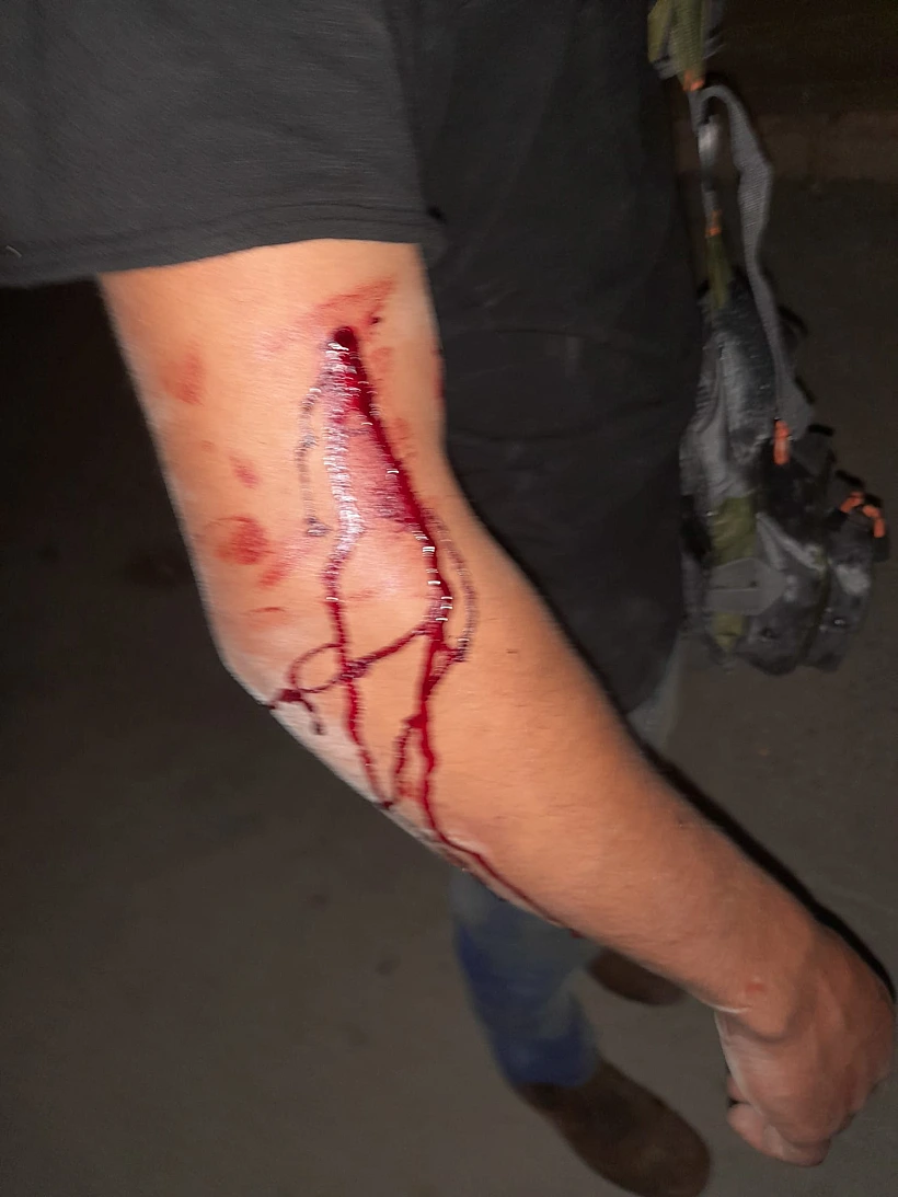 פציעות נער תקיפה עכו עיר עתיקה מקלות סכין