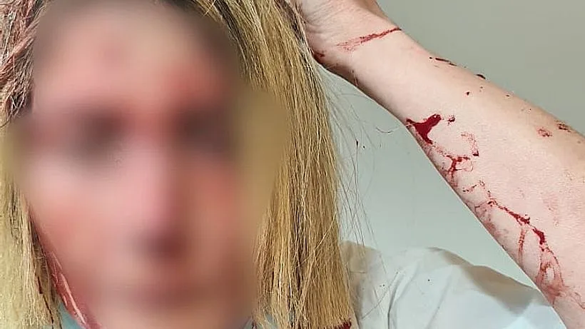 הרופאה שהותקפה בקופת החולים בבאר יעקב