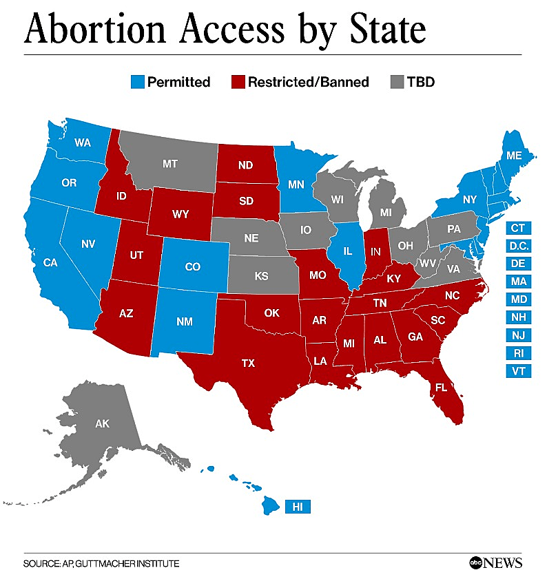 מפת ההפלות בארה''ב (באדום המדינות שבהן נאסרה ההפלה)