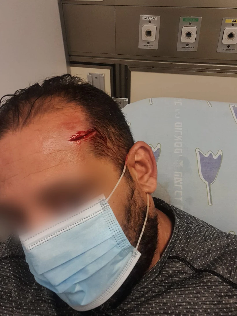 אחד הפצועים בקטטה במאפיית אבולעפיה