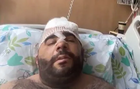 מור ג'נשווילי, שנפגע בלינץ' בעכו בשומר חומות, בשיחה עם חדשות 13