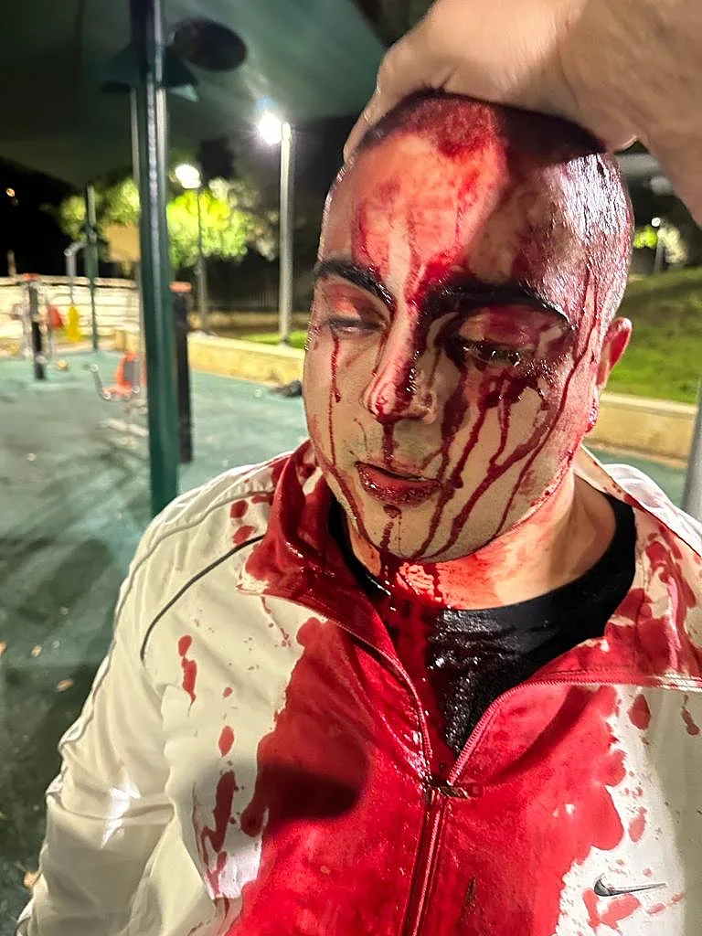 אורין בניאן, החייל שנפצע כשניסה להפריד בקטטה בין נערים