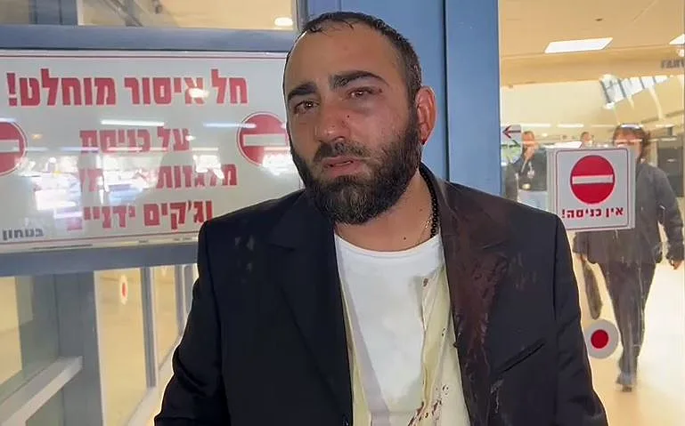 הפצוע שהותקף בקלנדיה