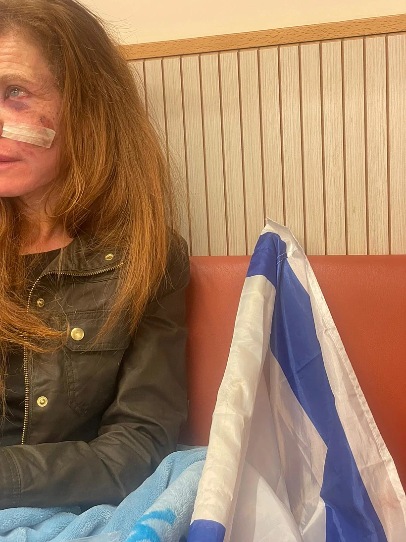 רימון הלם התפוצץ בפניה בזמן שהפגינה