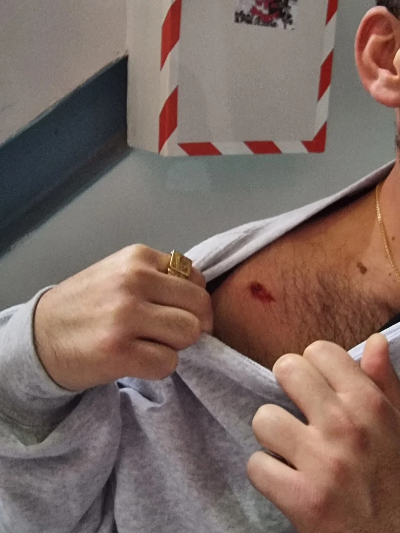 האוהד שנפצע