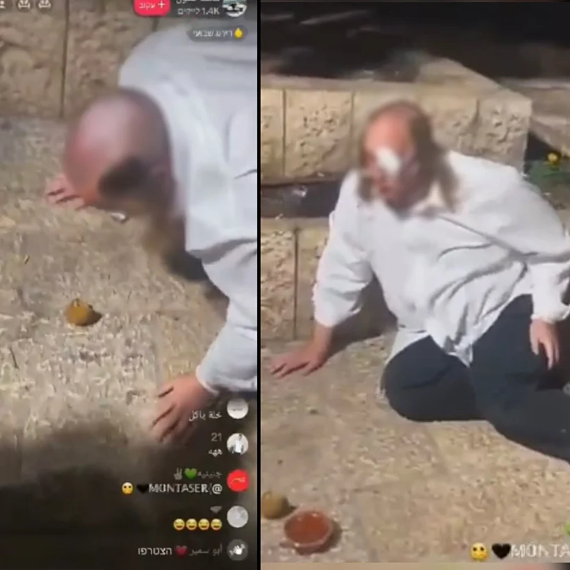 הבחור בו התעללו צעירים ממזרח ירושלים